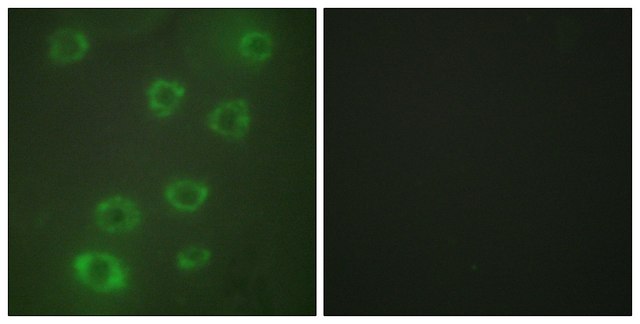 Anti-PTX3 antibody produced in rabbit