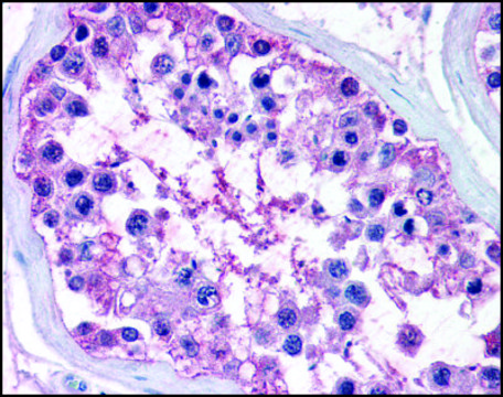 Anti-NR0B1 (AB1) antibody produced in