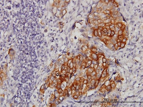 ANTI-EIF4G3 antibody produced in mouse