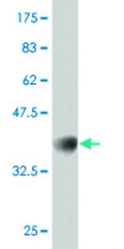 ANTI-GUCY2C antibody produced in mouse