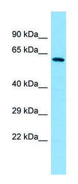 Anti-YTHDF2 (C-terminal) antibody produced in