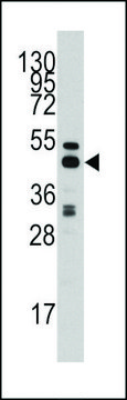 ANTI-S ADENOSYLHOMOCYSTEINE HYDROLASE (ACHY)(C-TERMINAL) antibody