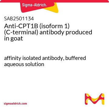 Anti-CPT1B (isoform 1) (C-terminal) antibody
