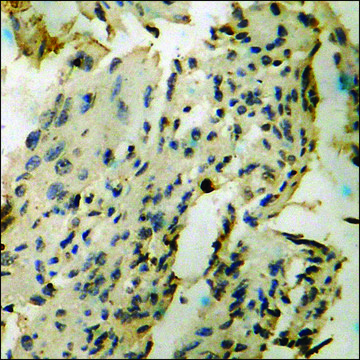 Anti-phospho-NF-kappaB p65 (pThr?³?) antibody produced