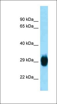 Anti-SKA1 antibody produced in rabbit