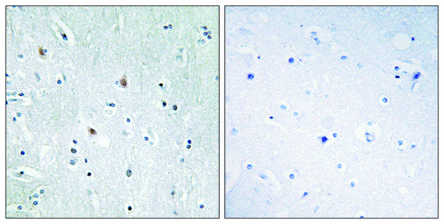 Anti-SOX12 antibody produced in rabbit