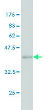 ANTI-FHIT antibody produced in mouse