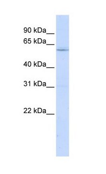 Anti-LRRC15 antibody produced in rabbit