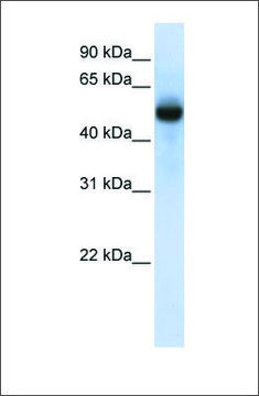 Anti-CXORF34 antibody produced in rabbit