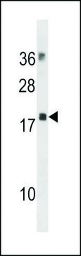 ANTI-MYL12B (N-TERM) antibody produced in
