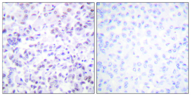 Anti-Histone H2B antibody produced in