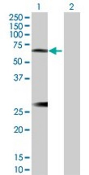 Anti-IL6R antibody produced in rabbit
