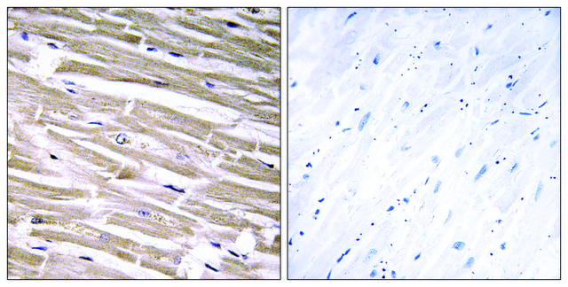 Anti-B3GALT2 antibody produced in rabbit