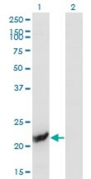Monoclonal Anti-GUK1, (C-terminal) antibody produced
