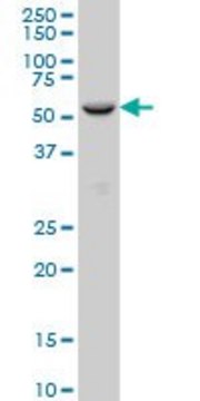 Monoclonal Anti-FOXC2, (C-terminal) antibody produced
