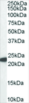 Anti-Glutathione peroxidase 1 (ISO1) antibody