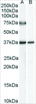 Anti-ACOX2 (AB2) antibody produced in