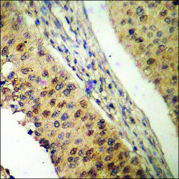 Anti-phospho-APC1 (pSer???) antibody produced in
