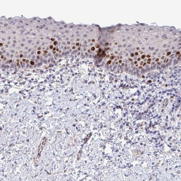 Anti-SETD7 antibody produced in rabbit