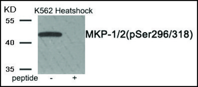 Anti-phospho-MKP-1/2 (pSer296/318) antibody produced in