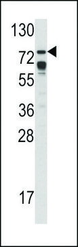 ANTI-B-RAF (S601) antibody produced in