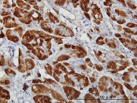 Monoclonal Anti-CTH antibody produced in