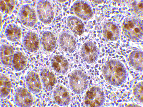 Anti-AATF antibody produced in rabbit
