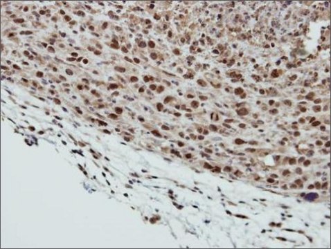 Anti-SMC6 antibody produced in rabbit