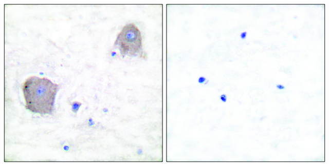 Anti-MGLUR4 antibody produced in rabbit