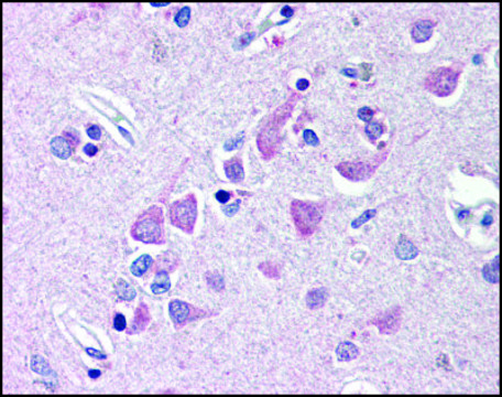 Anti-FEM1B antibody produced in rabbit