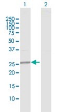 Anti-GAMT antibody produced in rabbit