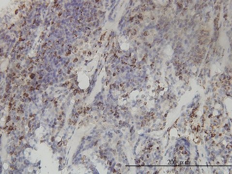 Monoclonal Anti-MTHFD2 antibody produced in