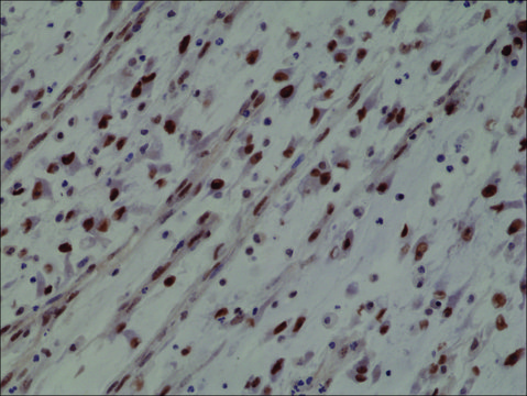 Anti-MyoD1 antibody, Rabbit monoclonal