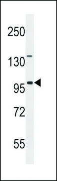 ANTI-ITIH5 (C-TERM) antibody produced in