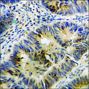 Anti-phospho-FAK (pTyr³??) antibody produced in
