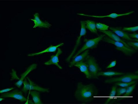 Anti-PSME1 antibody produced in rabbit