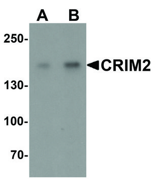 Anti-CRIM2 antibody produced in rabbit