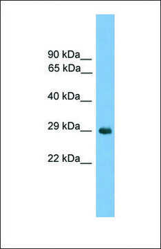 Anti-NKX1-2 antibody produced in rabbit