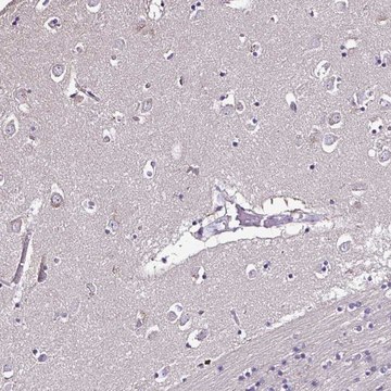 Anti-CCDC85C antibody produced in rabbit