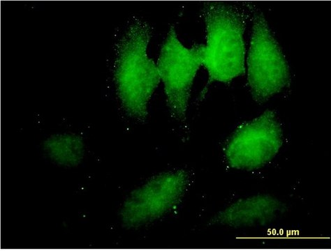 Monoclonal Anti-TOMM34 antibody produced in