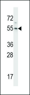 ANTI-HM13(C-TERMINAL) antibody produced in rabbit
