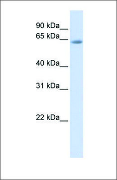 Anti-TCF7L2 (ab2) antibody produced in