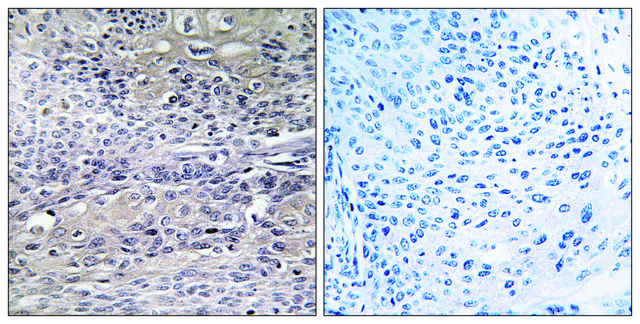 Anti-IREB1 antibody produced in rabbit
