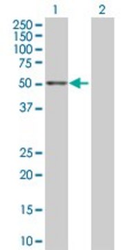 Anti-ALDH3A2 antibody produced in rabbit