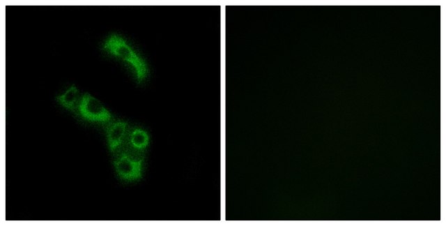 Anti-C1QB, C-Terminal antibody produced in