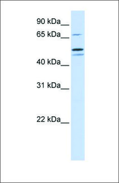 Anti-EARS2 antibody produced in rabbit