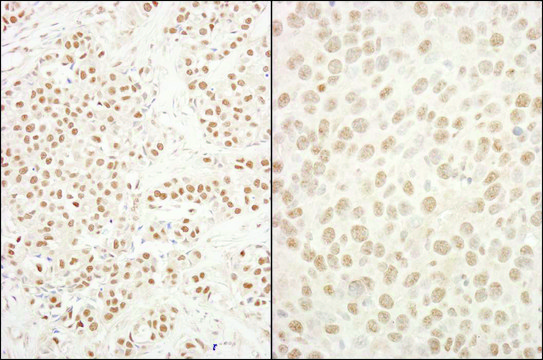 Rabbit anti-BRG1/SMARCA4 Antibody, Affinity Purified