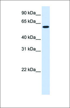 Anti-UGT8 antibody produced in rabbit