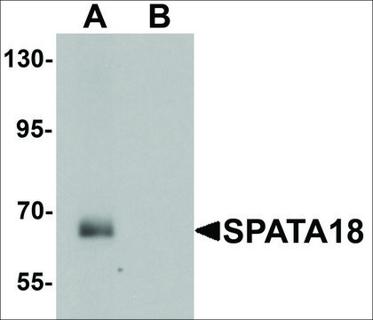 Anti-SPATA18 antibody produced in chicken