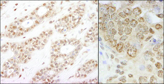 Rabbit anti-IKK-alpha Antibody, Affinity Purified